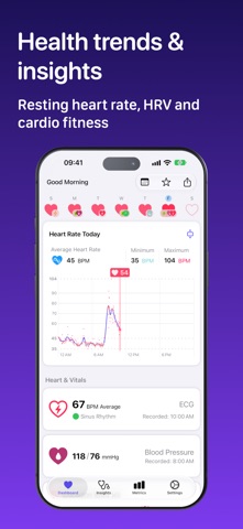 Heart Analyzer · 心率趋势分析 官方商店截图 2